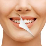 神澤先生も推奨！歯科医院で受けられるホワイトニング